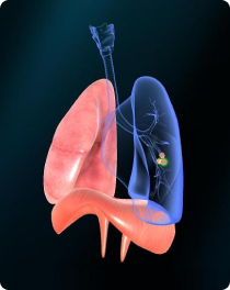 lungs system